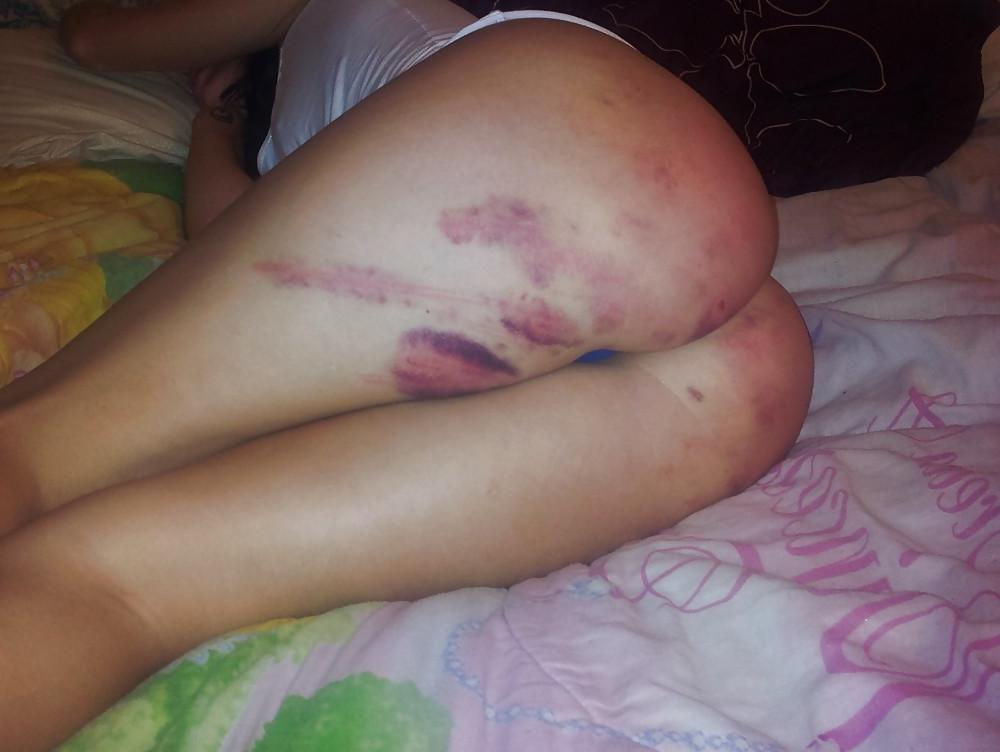 25P Spanked Asses 11