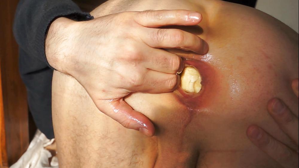 17P Fucking prolapse and gaping April 2013