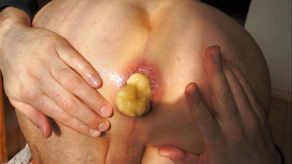 17P Fucking prolapse and gaping April 2013
