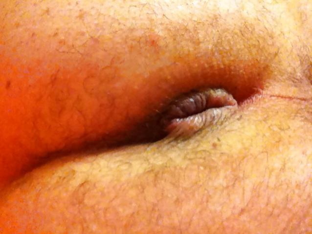 9P My Little Hole