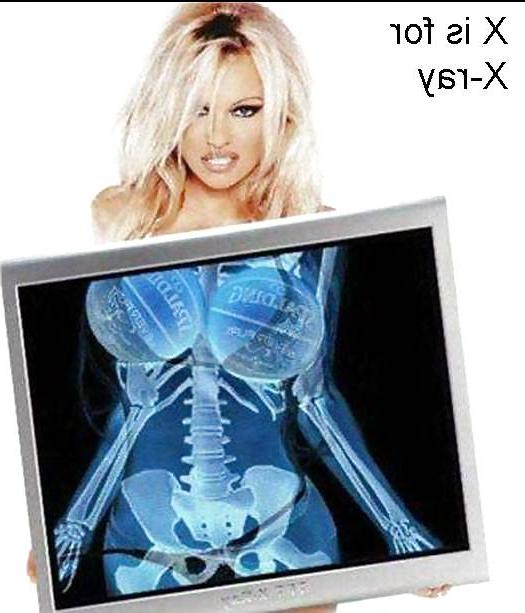 25P Boobs A - Z