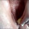 7P Suck stuff in hole