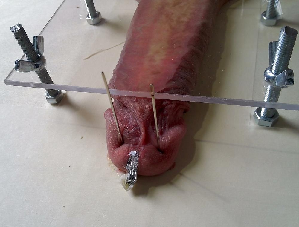6P Cbt Needle Extrem