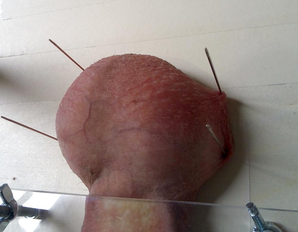 6P Cbt Needle Extrem