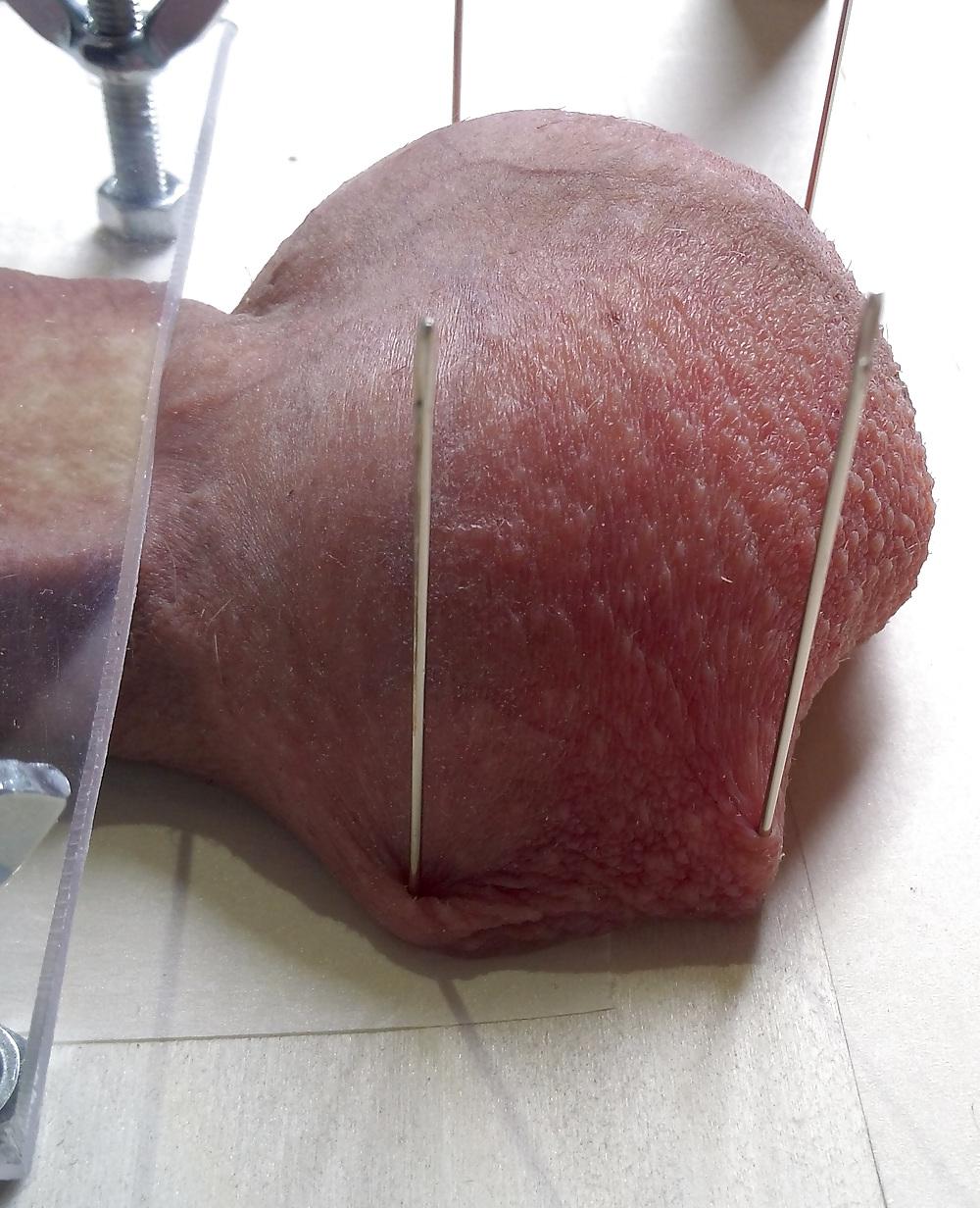 6P Cbt Needle Extrem