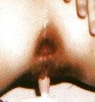 4P Anal Pics Close-Up By X