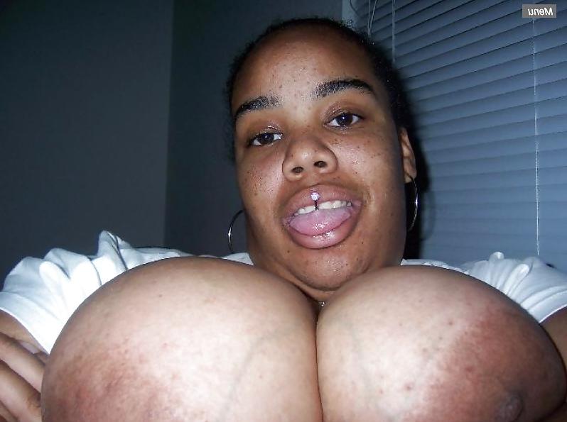 9P OMG 2