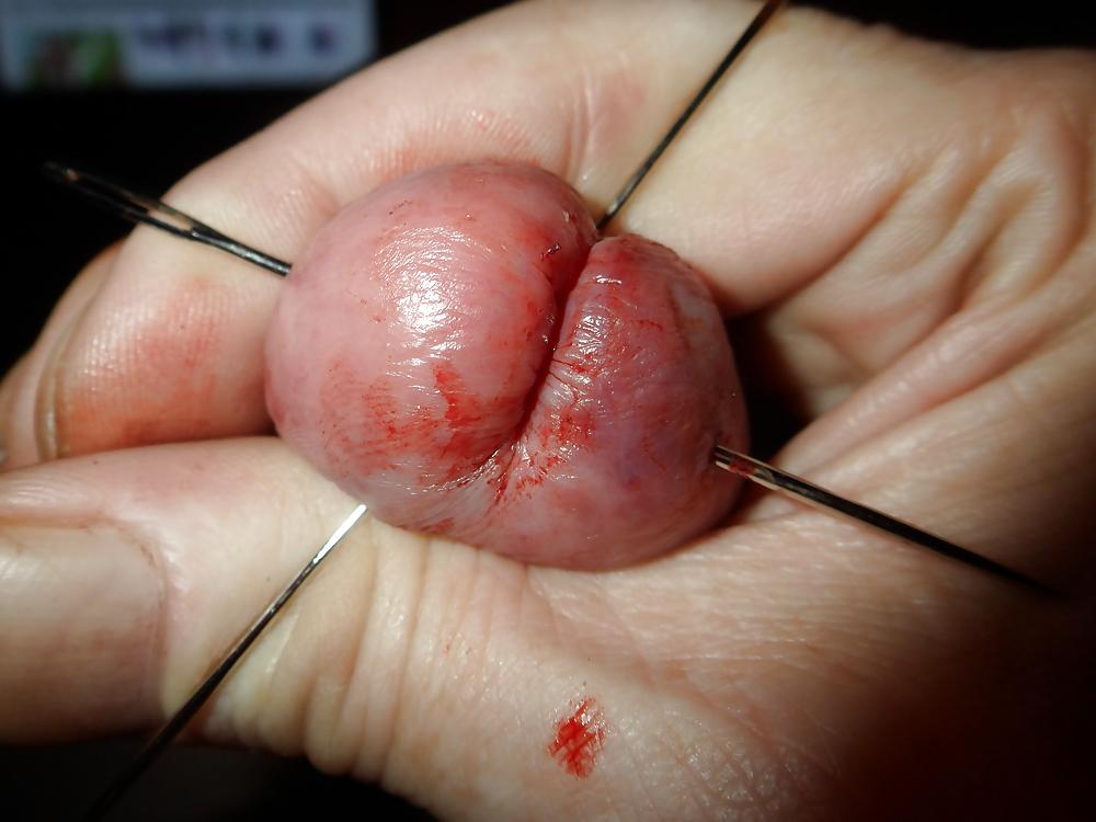 25P Close up needle & cotton cbt