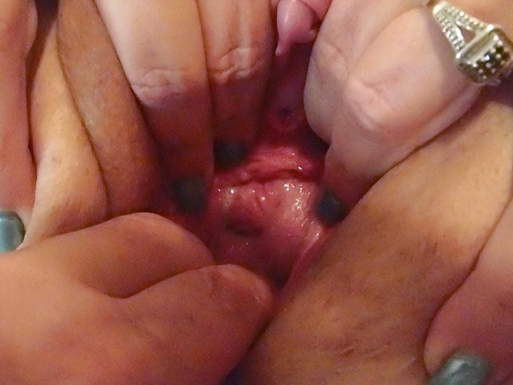 15P Anal fun and gaping 