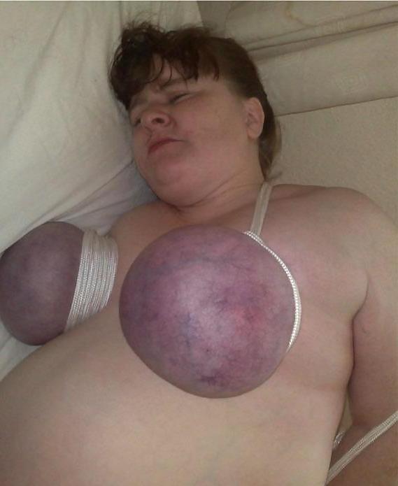 25P Breast Bondage #6