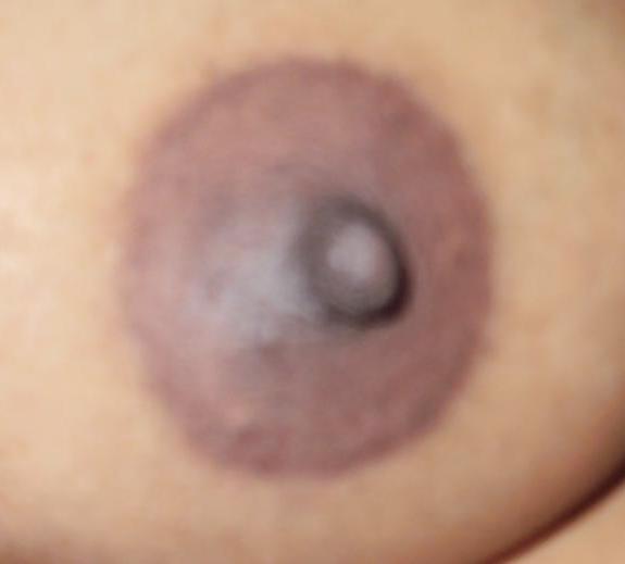14P Indian Nipple