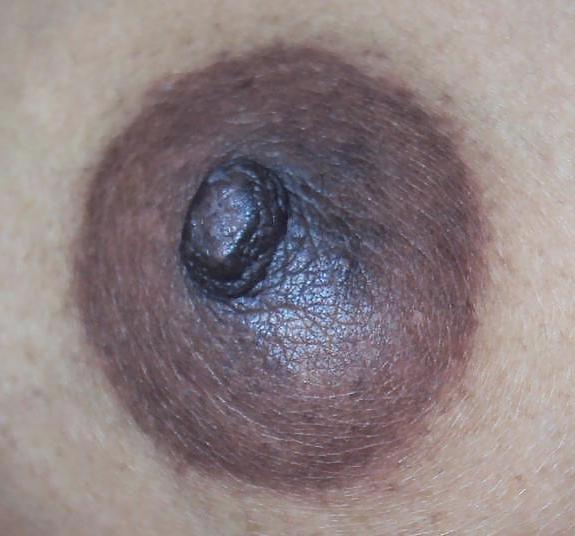 14P Indian Nipple
