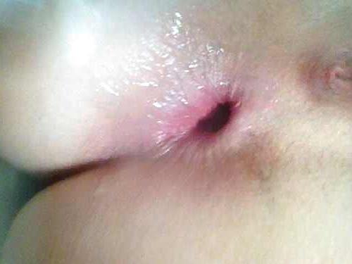 25P Hole Show III