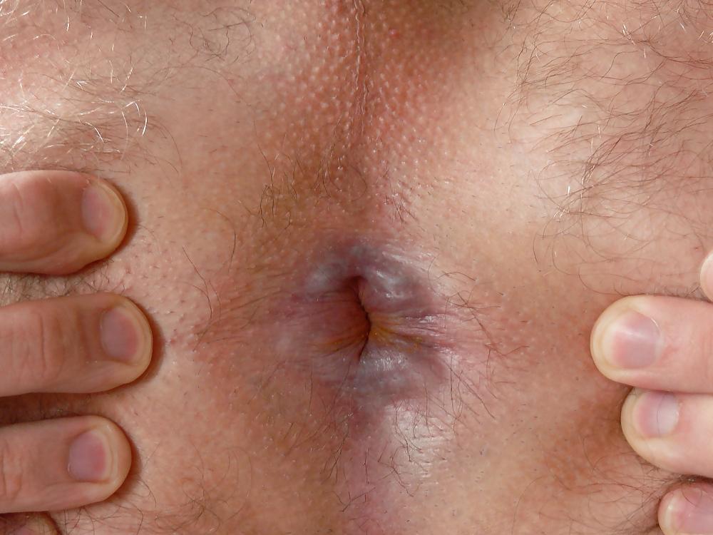 10P Backdoor Closeup