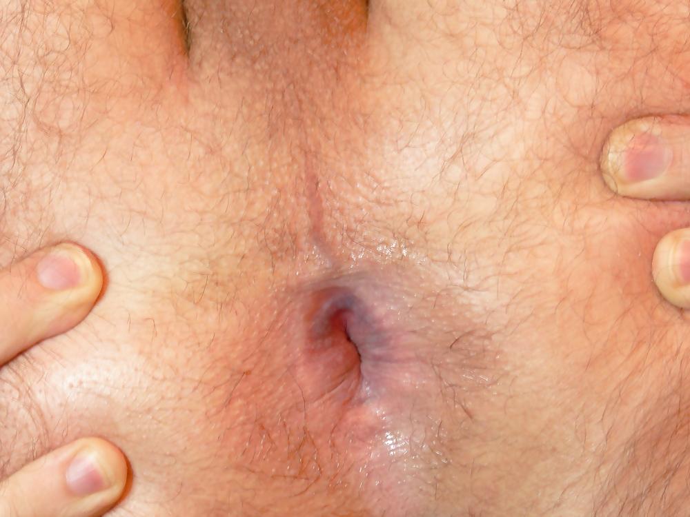 10P Backdoor Closeup