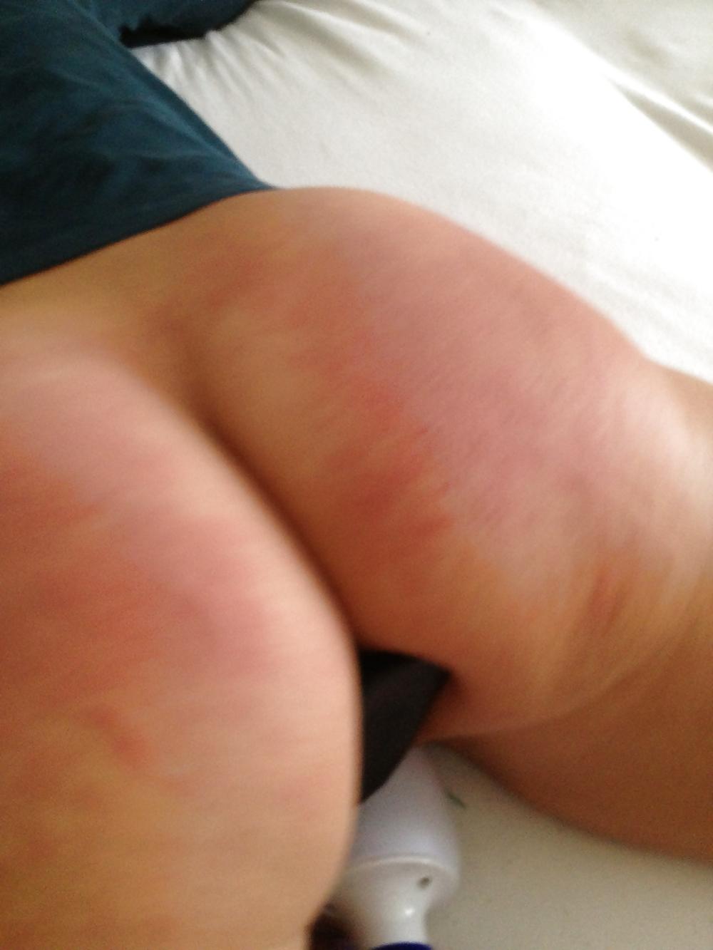 25P Spanked asses 18