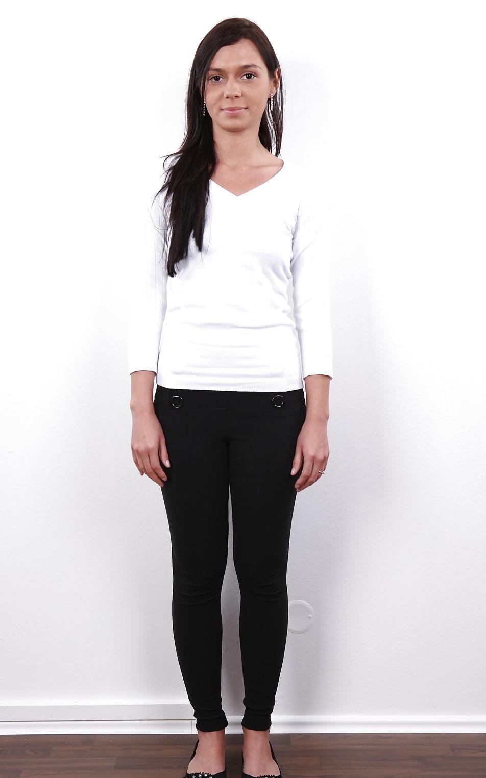 7P Casting 32