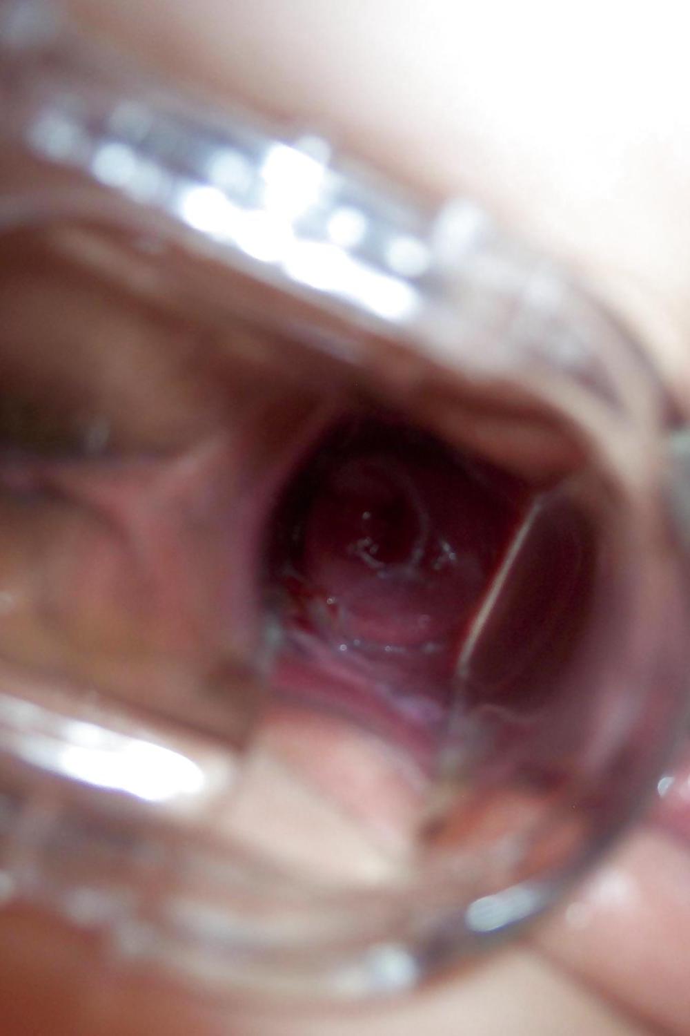 13P Mama mit Speculum