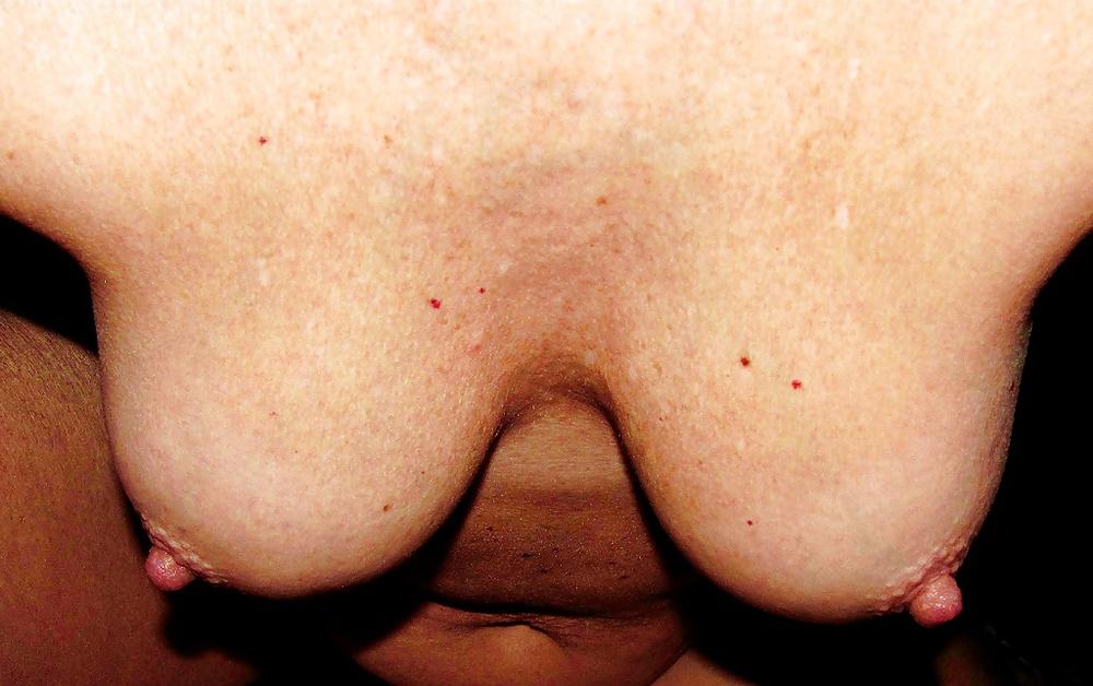 16P Mature Wife Tits & Nipples 2