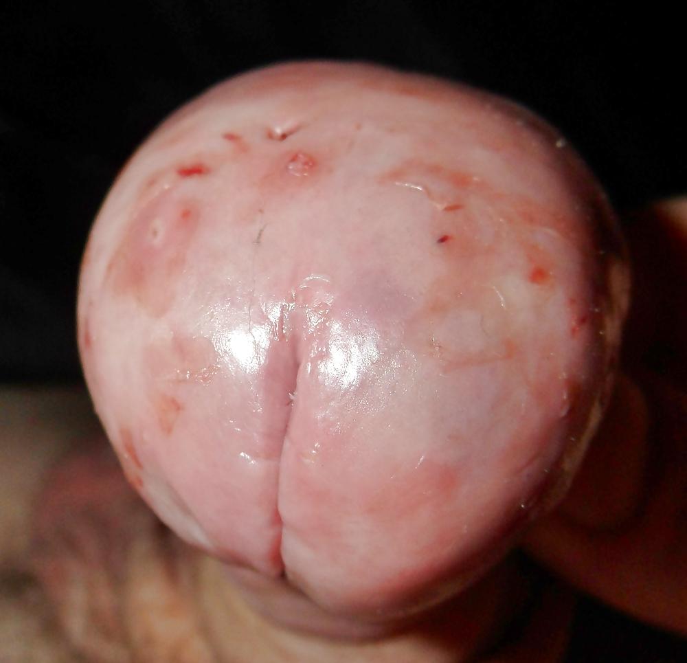 20P Stretched pined cbt