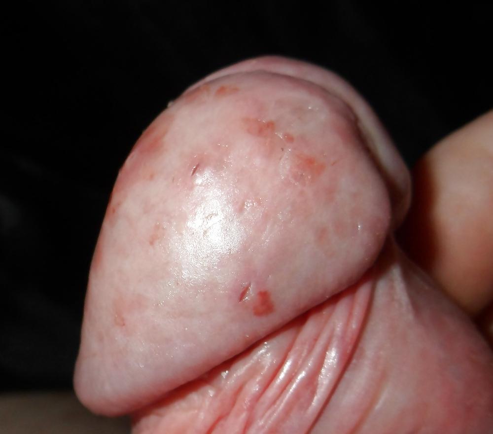 20P Stretched pined cbt