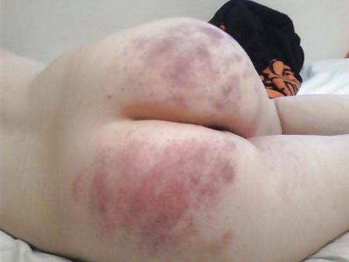 25P Spanked Asses 23