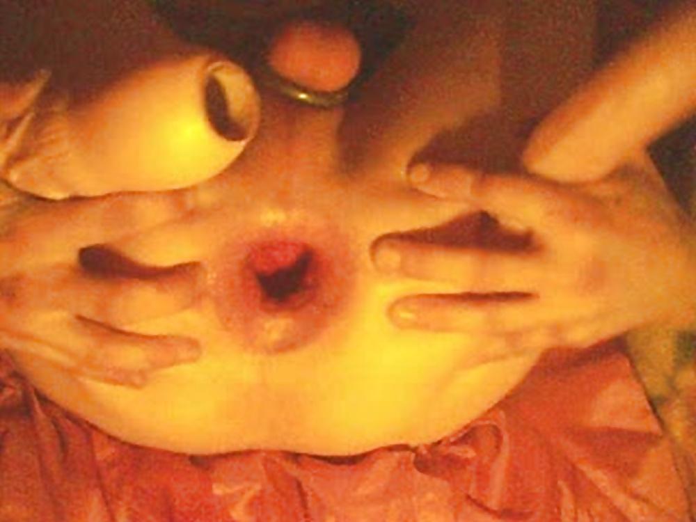 12P Explore my hole
