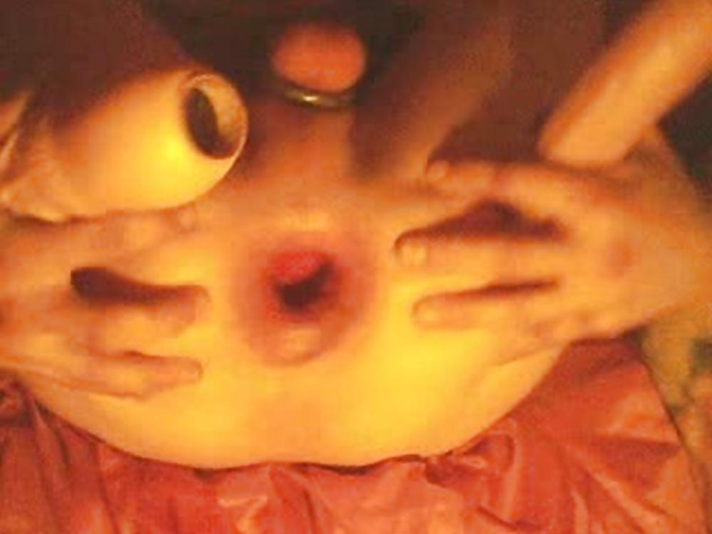 12P Explore my hole