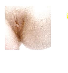 14P Anna hole