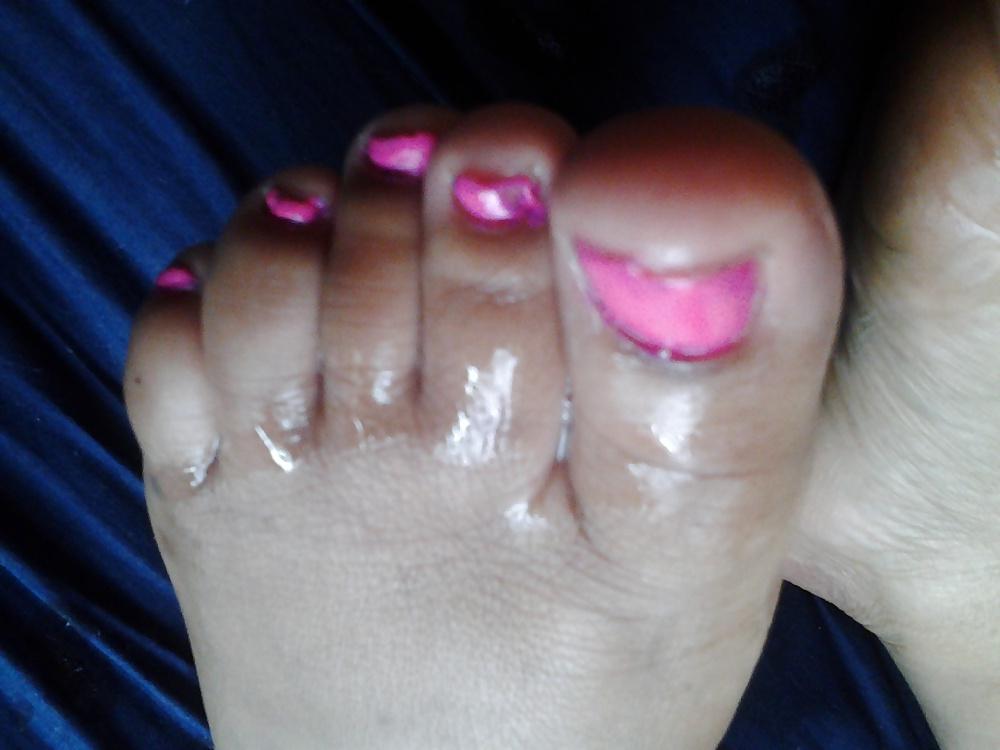 4P BBW-Füße