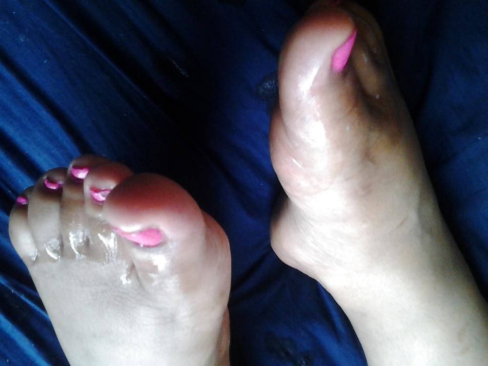4P BBW-Füße