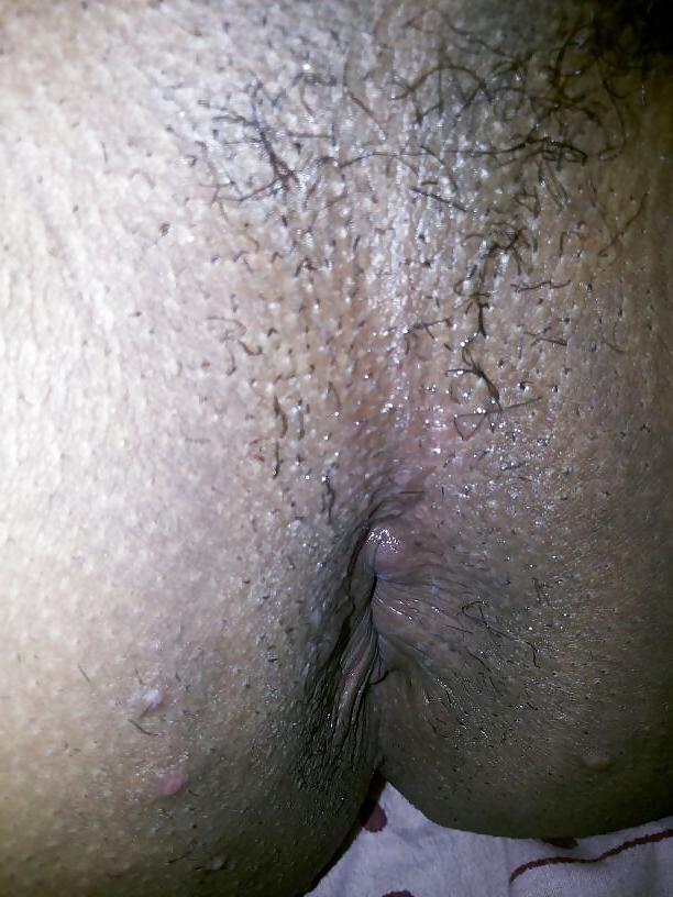 4P Gross ass hole real pics