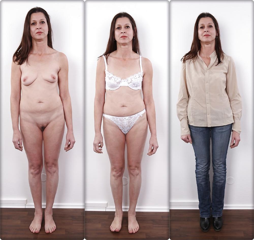 20P Casting Dressed & Undressed