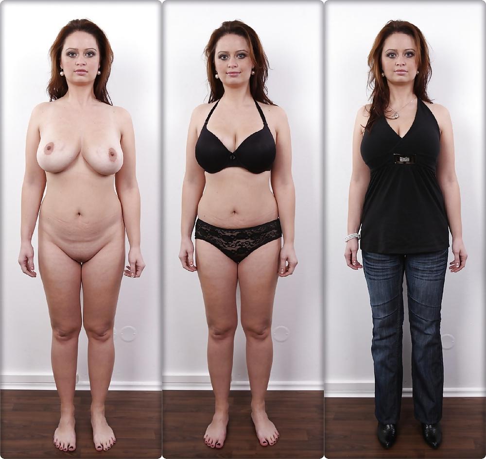 20P Casting Dressed & Undressed
