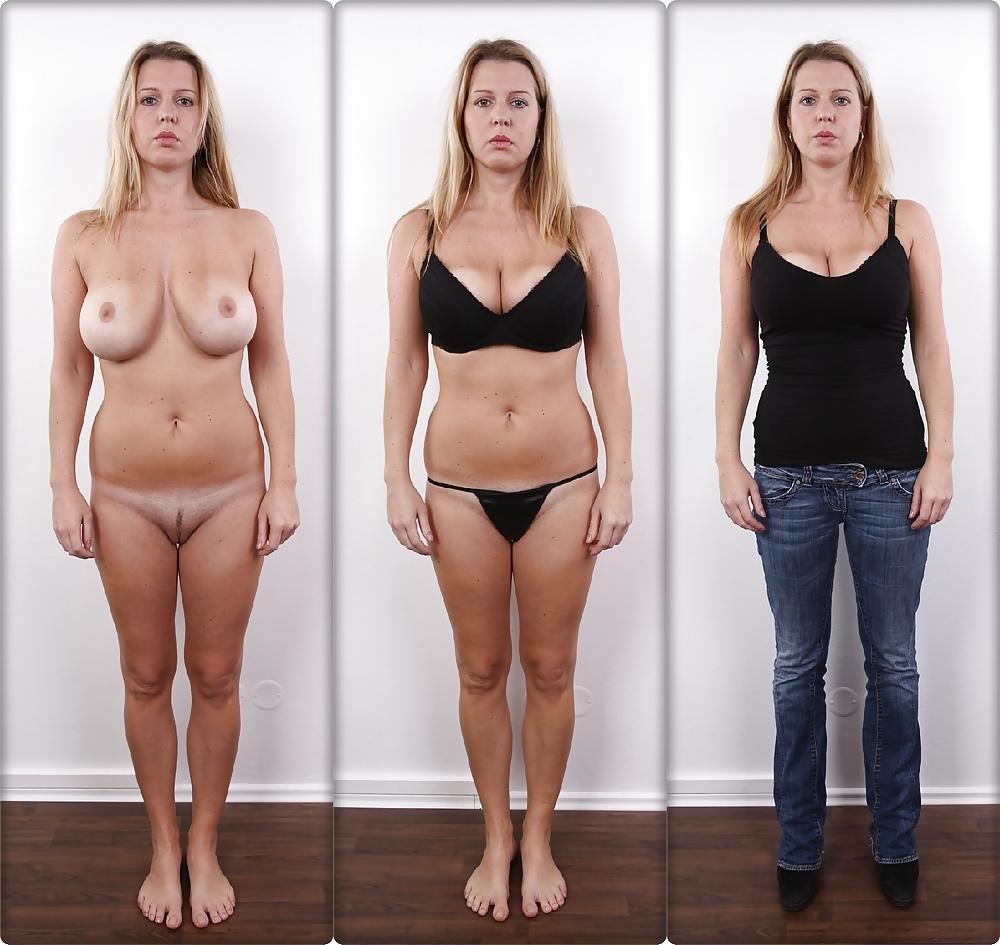 20P Casting Dressed & Undressed