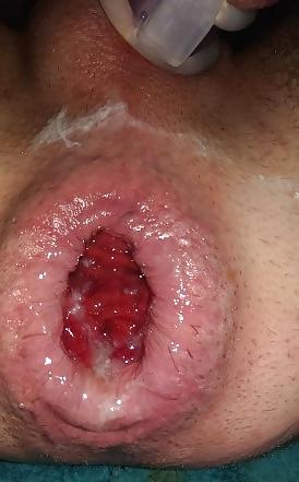 5P Nice gaping male cunt