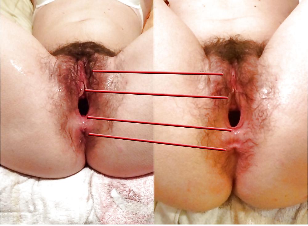 15P Comparing demgpe's Hole