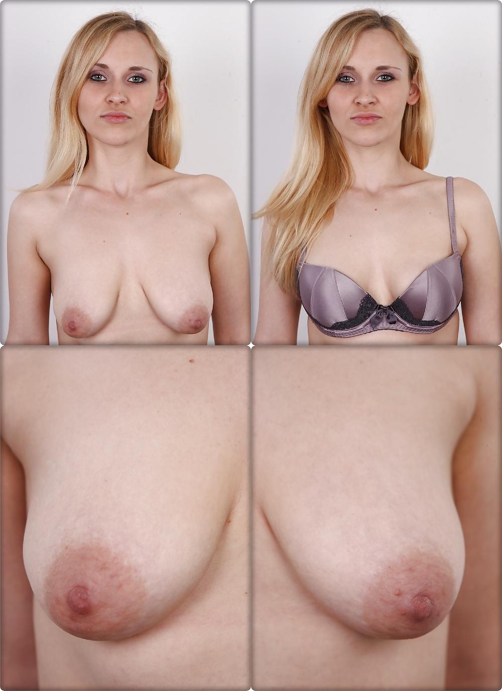 25P Casting Dressed & Undressed 4