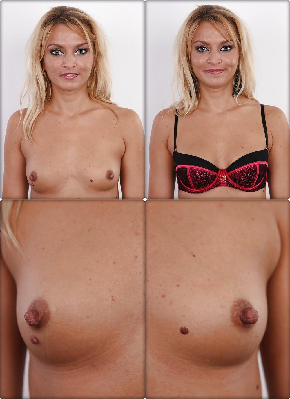 25P Casting Dressed & Undressed 4