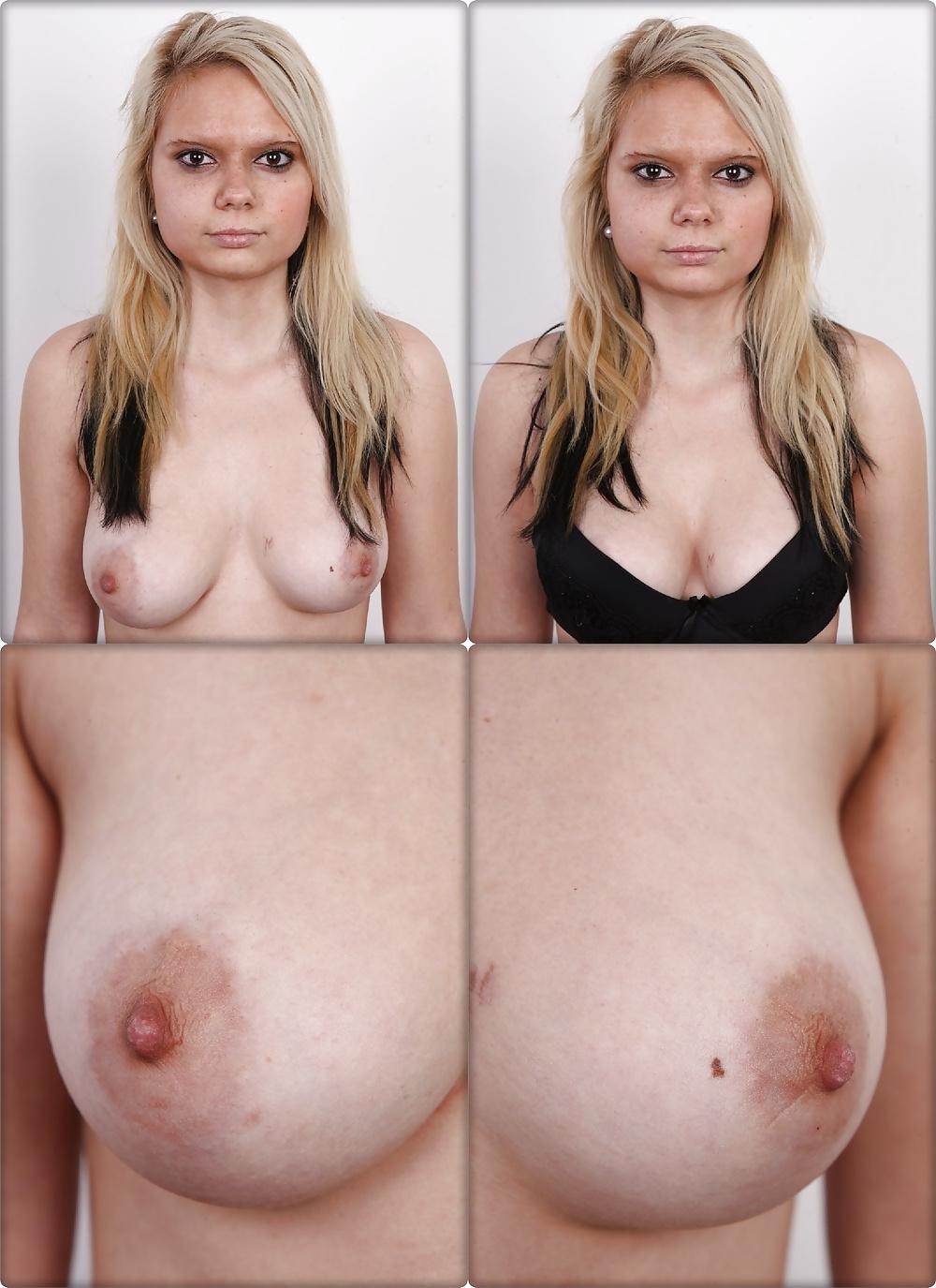 25P Casting Dressed & Undressed 4