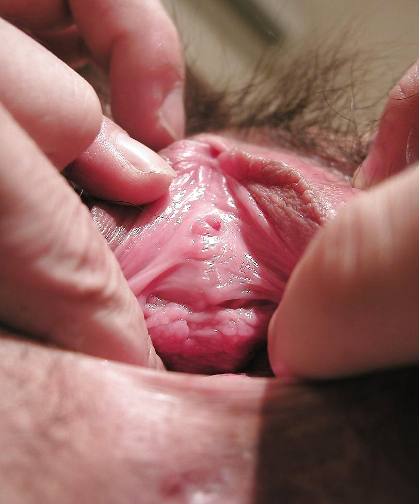 14P Speculum