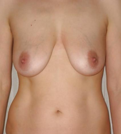 4P Tits closeup...