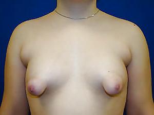 25P Saggy Tits 44 (by Rodi)
