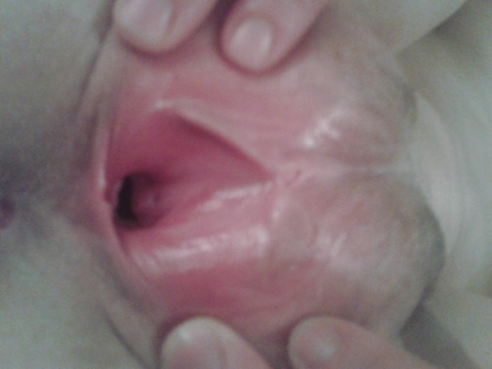 25P Amateur pictures slut wife teen(coments)