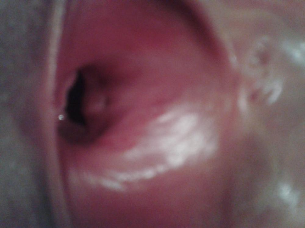25P Amateur pictures slut wife teen(coments)