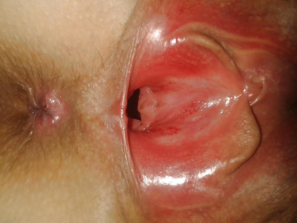 25P Amateur pictures slut wife teen(coments)