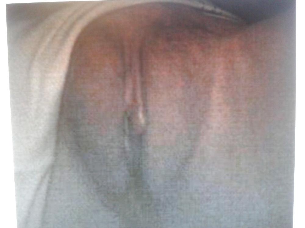 25P Amateur pictures slut wife teen(coments)