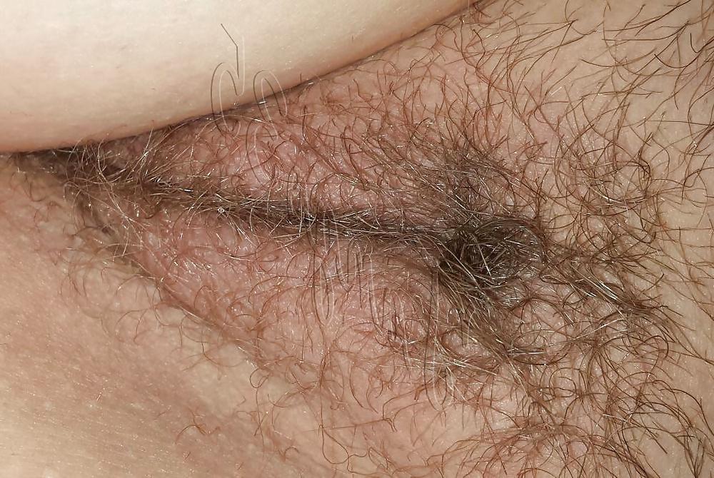 25P Turkish Sensual Couple
