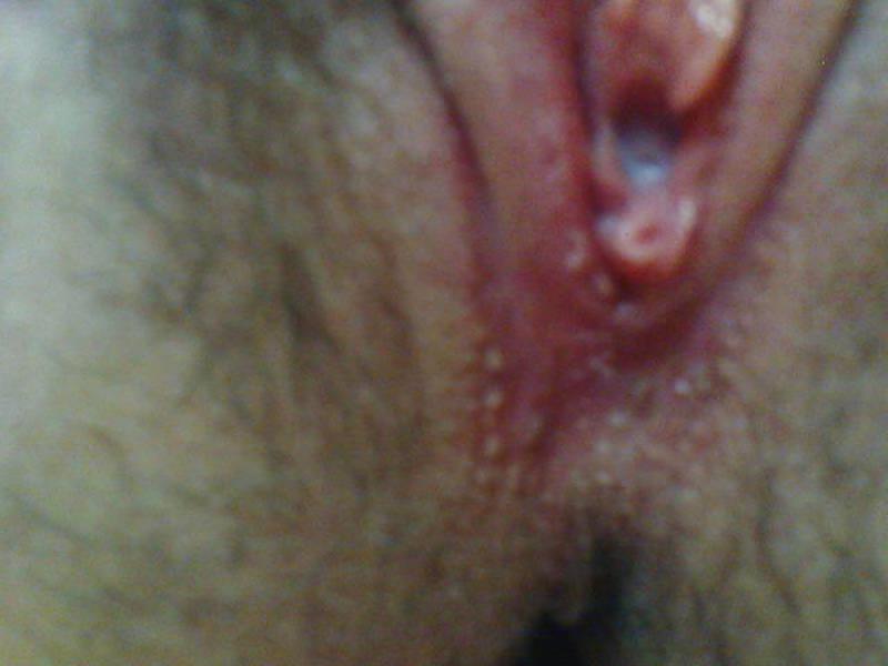 14P Pussy closeup