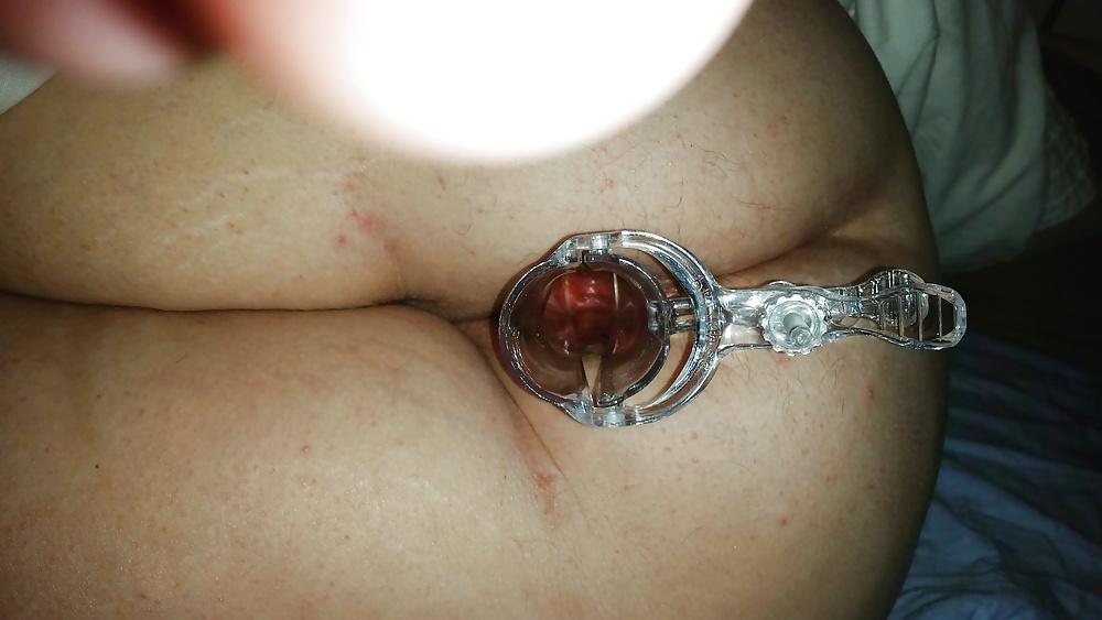 13P Speculum in wifes ass